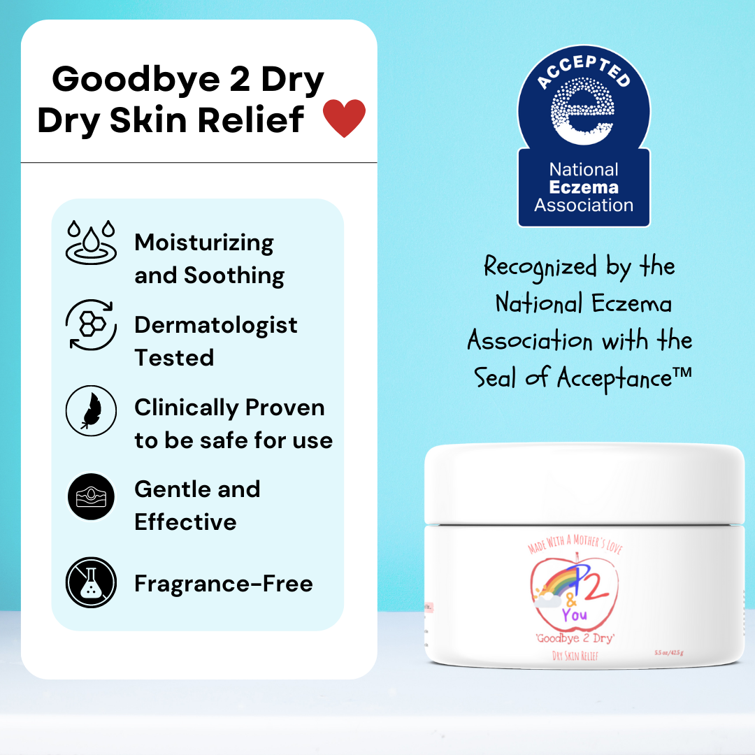 'Goodbye 2 Dry' Dry Skin Relief